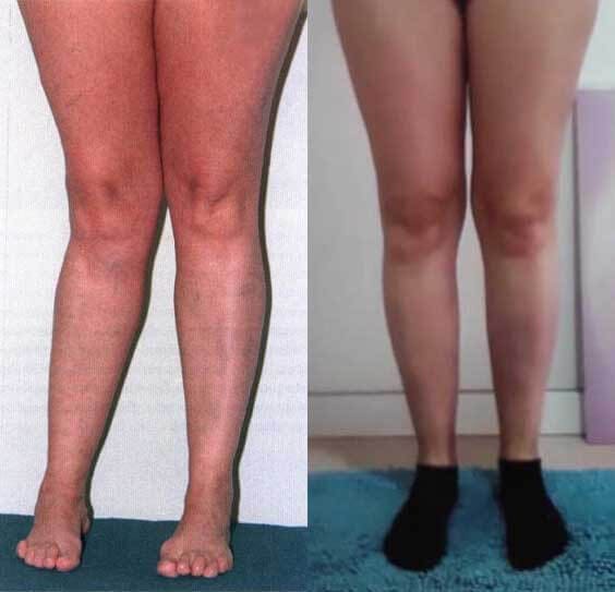 comment photo review