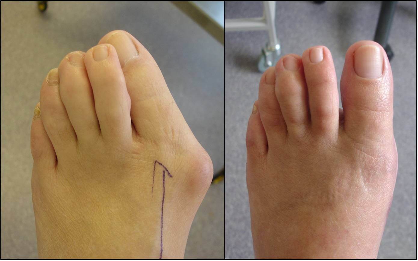 comment photo review