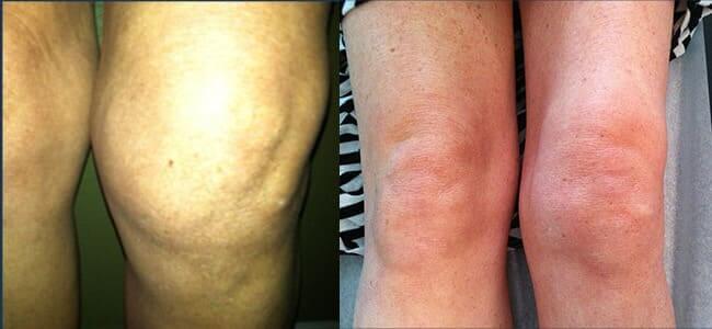 comment photo review